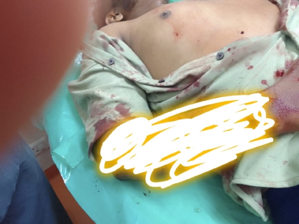 Near Periyanaickenpalayam in Coimbatore, in the Mathampalayam area, mysterious individuals intercepted a criminal who had recently been released on bail from prison due to prior enmity, attacked him with a sickle, and fled the scene. Police are conducting an investigation.