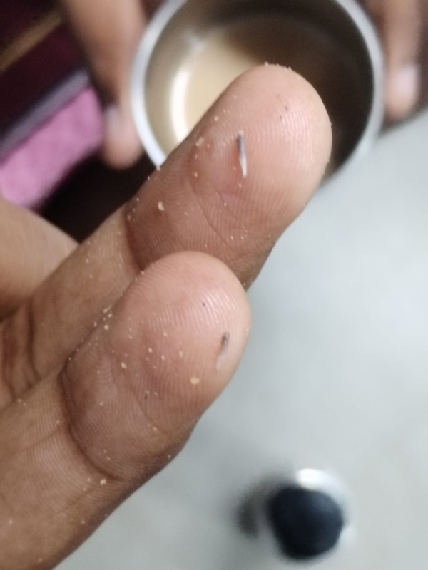 In a private college hostel in Coimbatore, insects were found in the night meal; five students suffered vomiting and dizziness – treated at a government hospital, police investigation underway!