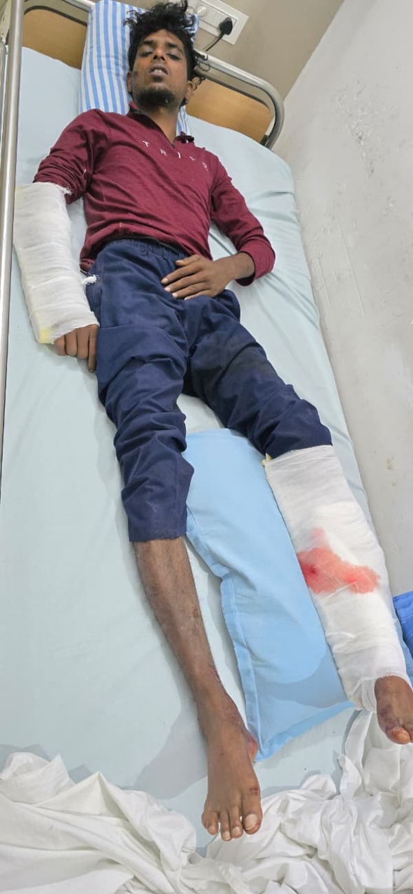 Two people who were selling drugs were caught — they fractured their legs after falling from a two-wheeler. Two people who were selling drugs were caught — they fractured their legs after falling from a two-wheeler.