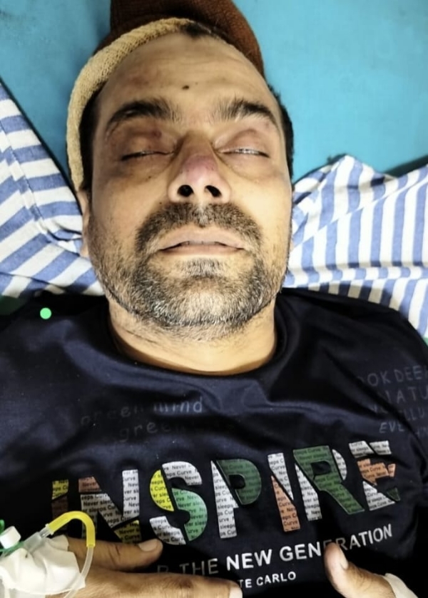 In connection with the robbery incident that took place in Coimbatore, the police shot and arrested three individuals from Uttar Pradesh yesterday, and among them, a person named Asif died at Coimbatore Government Hospital, causing shock. In connection with the robbery incident that took place in Coimbatore, the police shot and arrested three individuals from Uttar Pradesh yesterday, and among them, a person named Asif died at Coimbatore Government Hospital, causing shock.