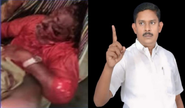 Kayal appash Kayal appash