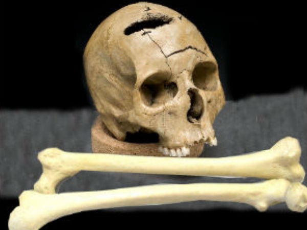 எலும்புக்கூடு